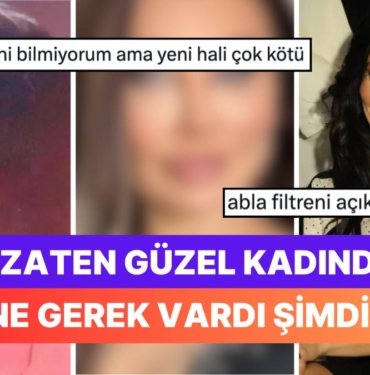Estetik Yaptırma Konusunda Dur Durak Bilmeyen Yerli Angelina Jolie’miz Umut Akyürek Son Halini Paylaştı