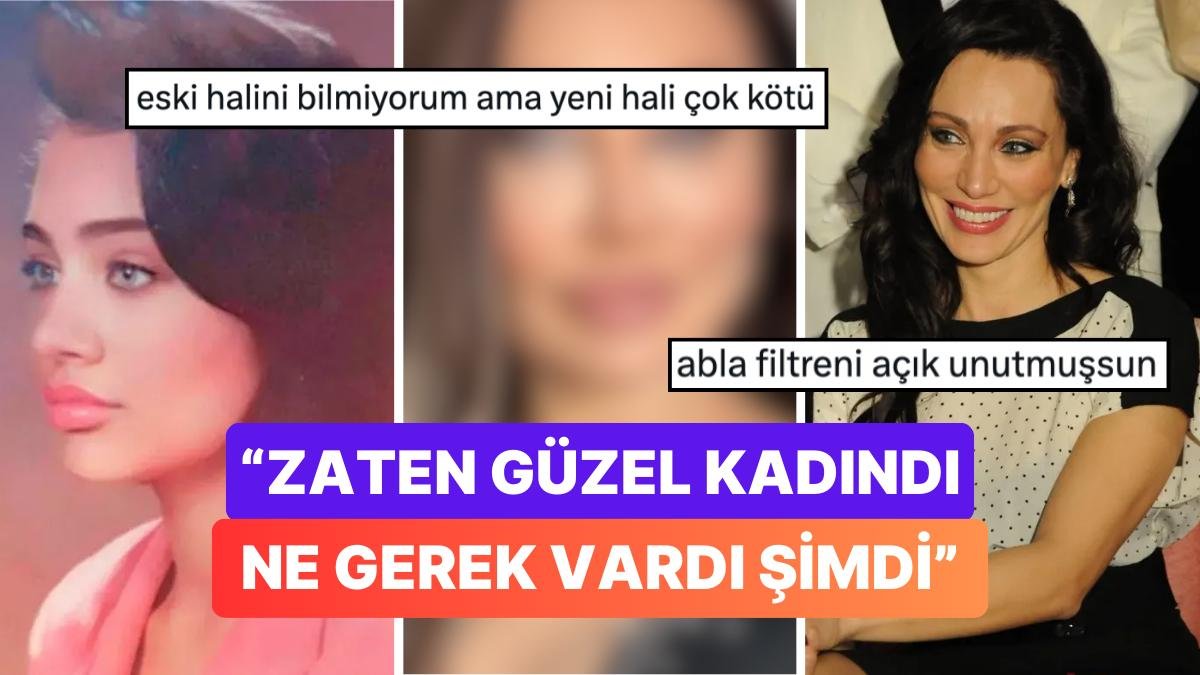 Estetik Yaptırma Konusunda Dur Durak Bilmeyen Yerli Angelina Jolie’miz Umut Akyürek Son Halini Paylaştı