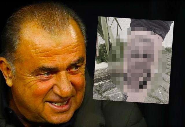 Yunanlar Fatih Terim aşkını vücuduna kazıdı! Panathinaikos taraftarından Terim dövmesi