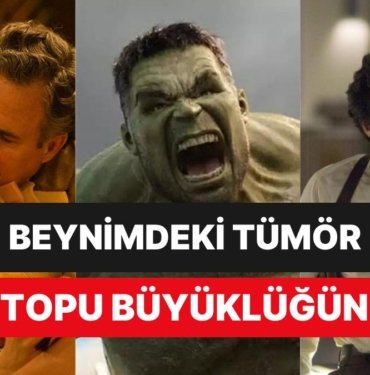 Avengers Yıldızı Ünlü Oyuncu Beyninde Tümör Olduğunu Rüyasında Gördüğünü Söylemesiyle Herkesi Üzdü