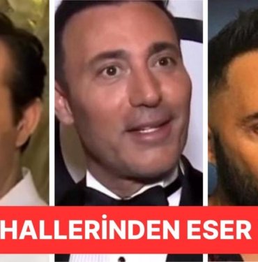 Son Dönemde Yaptırdıkları Estetik İşlemlerle Gündeme Gelen Ünlü İsimler