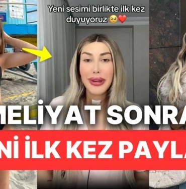 Cinsiyet Geçiş Ameliyatı Olan Fenomen Arda Bektaş Geçirdiği Operasyondan Sonra Sesini İlk Kez Paylaştı