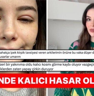İpek Kirpik Yüzünden Korneası Parçalanan Influencer Güzellik Merkezlerine Tövbe Etmenize Neden Olacak