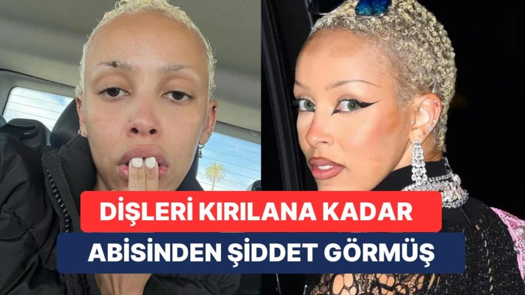 Abisi Tarafından Ağır Fiziksel ve Sözel Şiddet Gören Doja Cat’in Annesi Sessizliğini Bozdu ve Şikayetçi Oldu