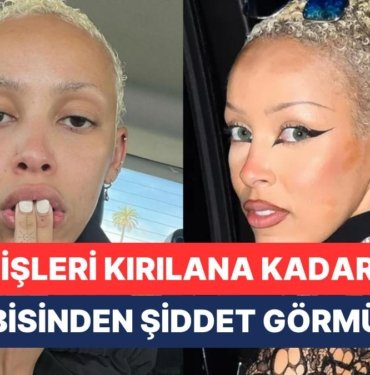 Abisi Tarafından Ağır Fiziksel ve Sözel Şiddet Gören Doja Cat’in Annesi Sessizliğini Bozdu ve Şikayetçi Oldu