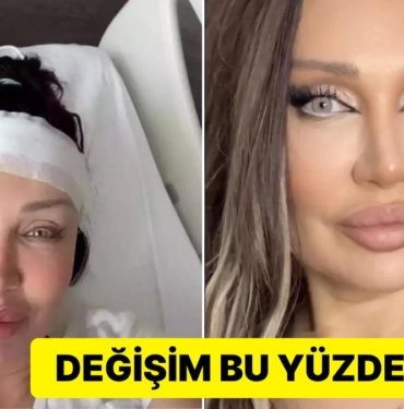 Son Haliyle Herkesi Şaşırtan Umut Akyürek Yüzündeki Değişimin Sebebini Böyle Açıkladı