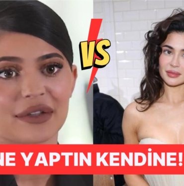 Kylie Jenner Fazla Botoks Sonucu Tamamen Çöken Yüz Hatlarıyla Bir Kez Daha Gündeme Geldi