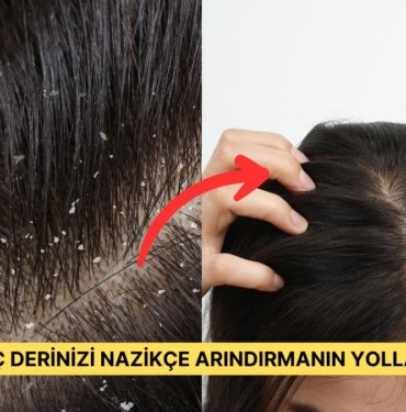 Saç Derinizi Zımparalar Gibi Kaşımak Yerine Bu 15 Ürünü Kullanarak Sorunu Kökten Çözün