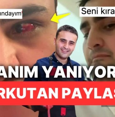 CZN Burak Son Videosunda Kesik ve Yara Dolu Hallerini “Canım Yanıyor” Diye Paylaşarak Herkesi Korkuttu