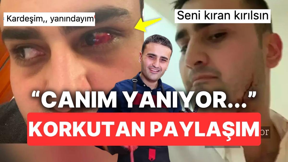 CZN Burak Son Videosunda Kesik ve Yara Dolu Hallerini “Canım Yanıyor” Diye Paylaşarak Herkesi Korkuttu