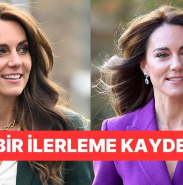 Galler Prensesi Kate Middleton’dan Güzel Haber: Geçirdiği Ameliyat Sonrası Taburcu Olup Saraya Döndü