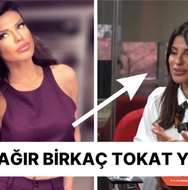 Bircan Bali Çarpıcı Açıklamalarda Bulundu: “Dar Pantolon Giydiğim İçin Eski Sevgilimden Şiddet Gördüm”