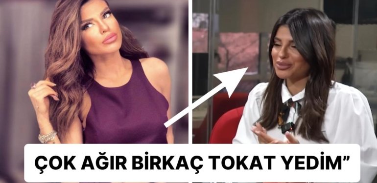 Bircan Bali Çarpıcı Açıklamalarda Bulundu: “Dar Pantolon Giydiğim İçin Eski Sevgilimden Şiddet Gördüm”