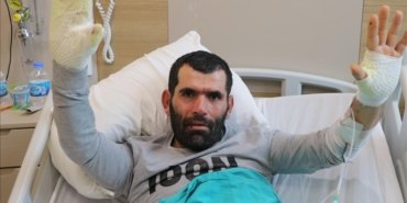 cocuklarina-yemek-pisirirken-nobet-gecirip-sobaya-dusen-ciftcinin-tedavisi-suruyor