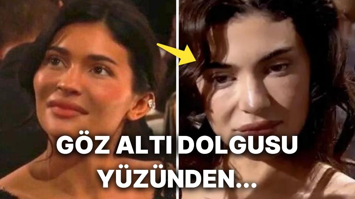 Kylie Jenner’ın Suratındaki Şişkinlik ve Yaşlı Görünümün Sebebini Uzman Doktorlar Açıkladı