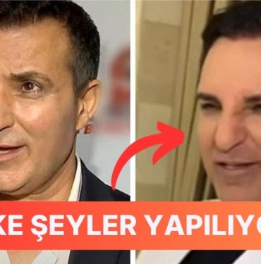 Estetik Furyasına Dahil Olan Rafet El Roman ‘Hiç Operasyon Olmadım’ Tepkisi ile Şaşırttı!