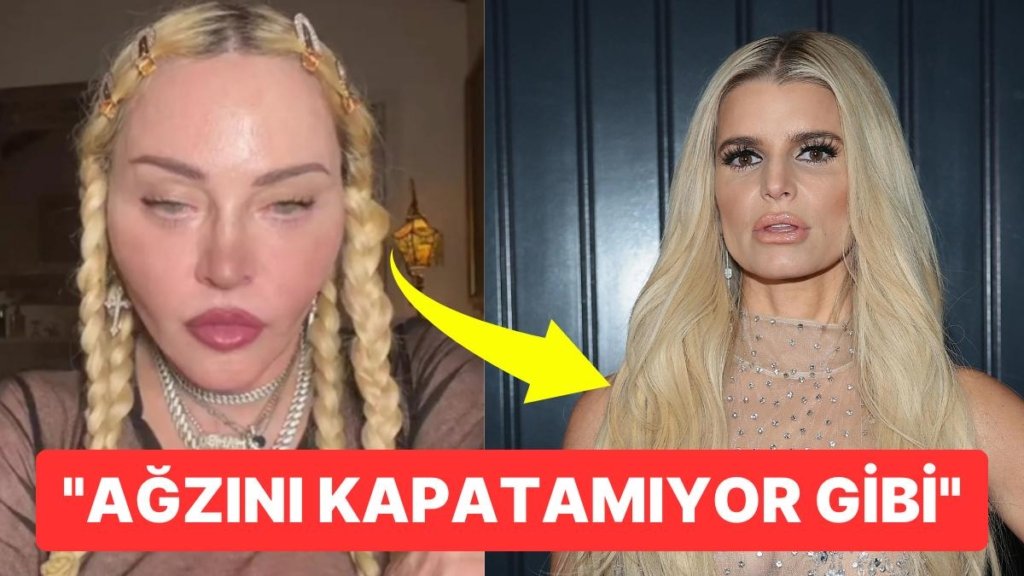 Geçirdikleri Estetik Operasyonları Abartarak Tamamen Başka Birine Dönüşen Dünyaca Ünlü İsimler