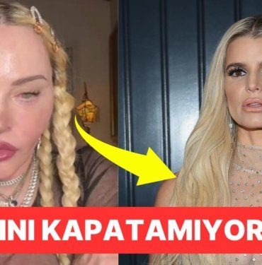 Geçirdikleri Estetik Operasyonları Abartarak Tamamen Başka Birine Dönüşen Dünyaca Ünlü İsimler