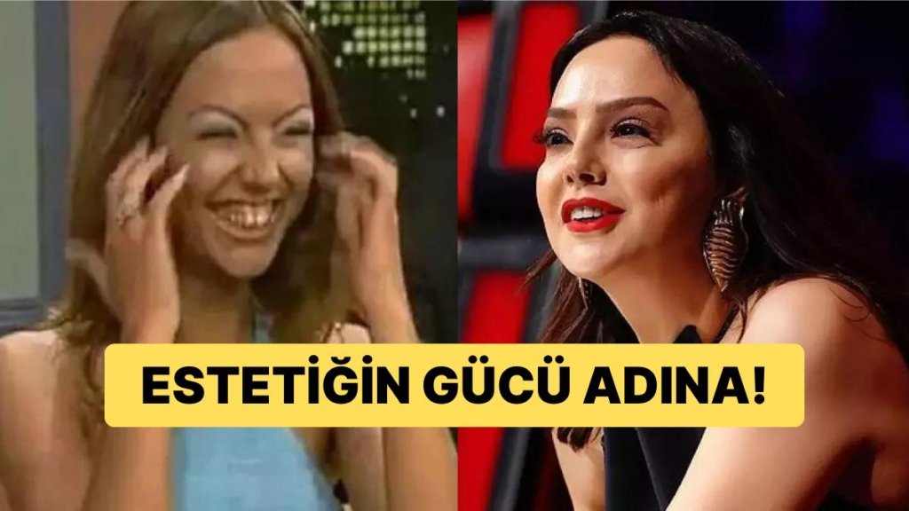 Küllerinden Adeta Yeniden Doğan Ünlü İsimler ‘Estetik Sen Nelere Kadirsin!’ Dedirtti