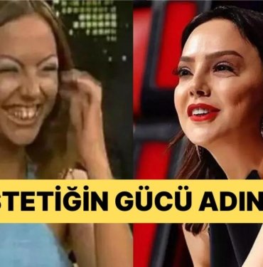 Küllerinden Adeta Yeniden Doğan Ünlü İsimler ‘Estetik Sen Nelere Kadirsin!’ Dedirtti