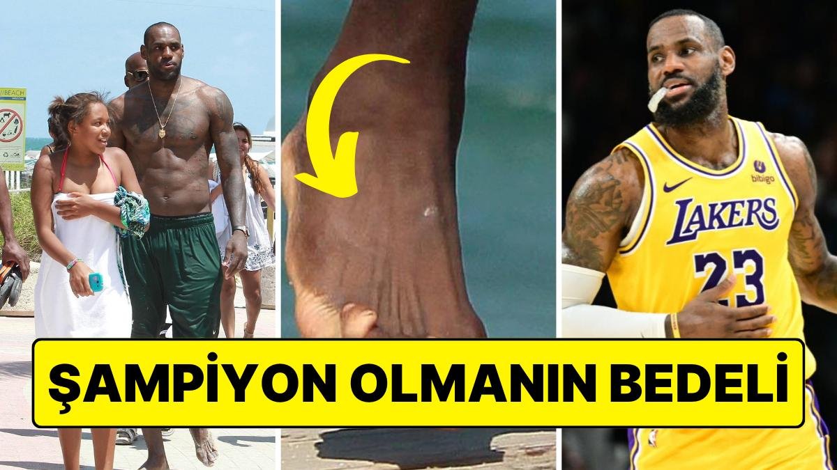 LeBron James’in Her Biri Farklı Yere Bakan Ayak Parmakları Yeniden Sosyal Medyanın Dilinde