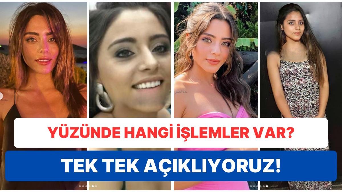 Kızılcık Şerbeti’nin Doğa’sı Sıla Türkoğlu’nun Yüzüne Yaptırdığı Estetikleri Tek Tek Açıklıyoruz!