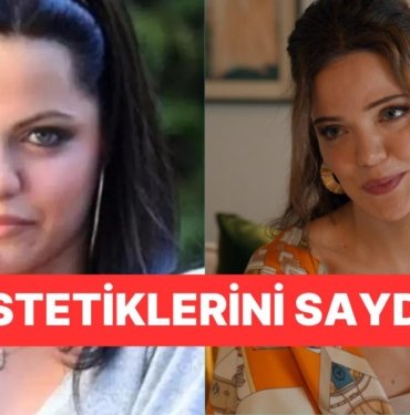 Değişimiyle Gündem Olan Hilal Altınbilek Estetiklerini Tek Tek Anlattı ve İsyan Etti!