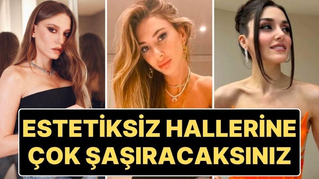 Gençlik (Estetiksiz) Halleriyle Şimdiki Halleri Arasında Dağlar Kadar Fark Olan Ünlülerin Şaşırtan Değişimleri