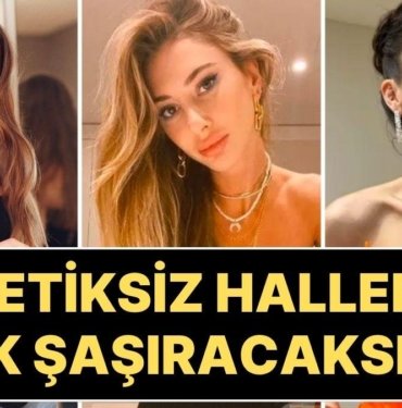 Gençlik (Estetiksiz) Halleriyle Şimdiki Halleri Arasında Dağlar Kadar Fark Olan Ünlülerin Şaşırtan Değişimleri