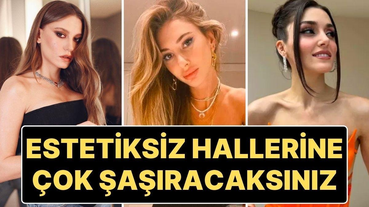 Gençlik (Estetiksiz) Halleriyle Şimdiki Halleri Arasında Dağlar Kadar Fark Olan Ünlülerin Şaşırtan Değişimleri