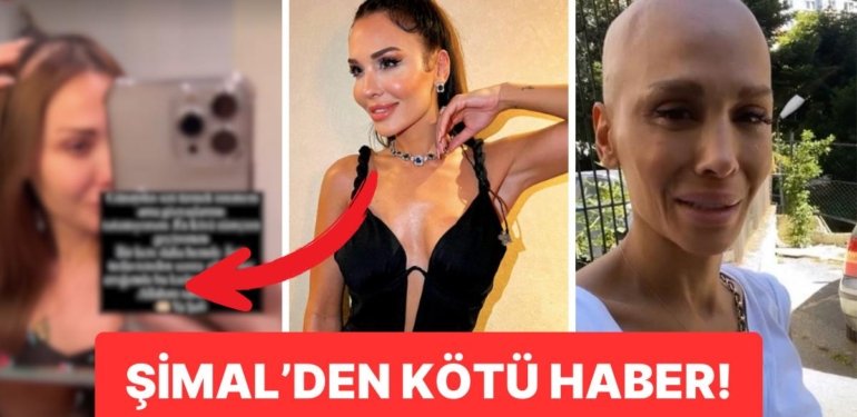 Beyninde Tümör Görülmüştü: Şarkıcı Şimal ‘Gözyaşlarımı Tutamıyorum’ Diyerek Dökülen Saçlarını Paylaştı!