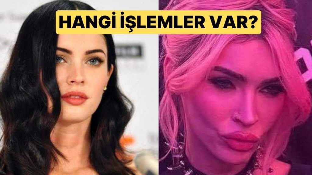 Eski Halini Mumla Aradığımız Megan Fox’un Estetik İşlemlerini Uzman Doktor Tek Tek Anlattı