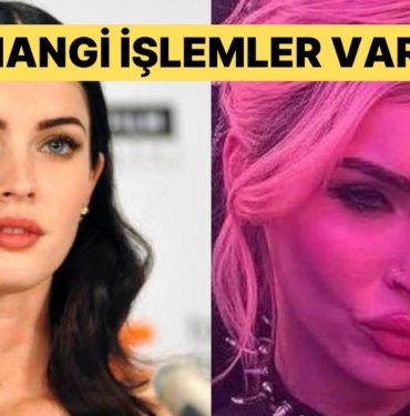 Eski Halini Mumla Aradığımız Megan Fox’un Estetik İşlemlerini Uzman Doktor Tek Tek Anlattı