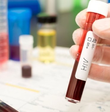 Türkiye’de HIV artış eğiliminde: Gizli pandemi gibi!