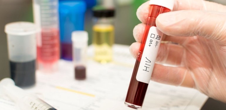Türkiye’de HIV artış eğiliminde: Gizli pandemi gibi!