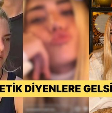 Survivor ile Hatırladığımız Aycan Yanaç Estetik İddialarına Okkalı Bir Cevap Verdi