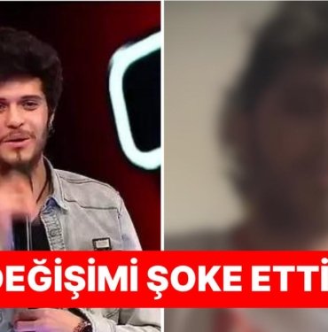 2016 O Ses Türkiye’nin Sesiyle Herkesi Büyüleyen Şampiyonu Emre Sertkaya’nın Yeni İmajı Görenleri Şoke Etti