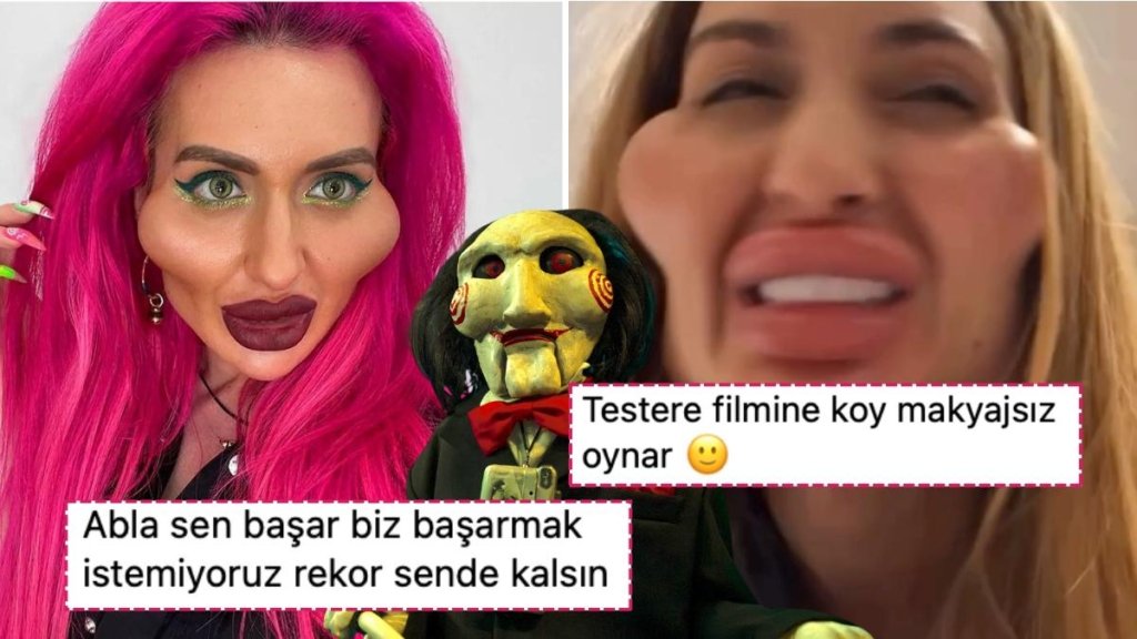 Dünyanın En Büyük Elmacık Kemiklerine Sahip Anastasia Ameliyat Olmak İçin Bir Kez Daha İstanbul’a Geldi!