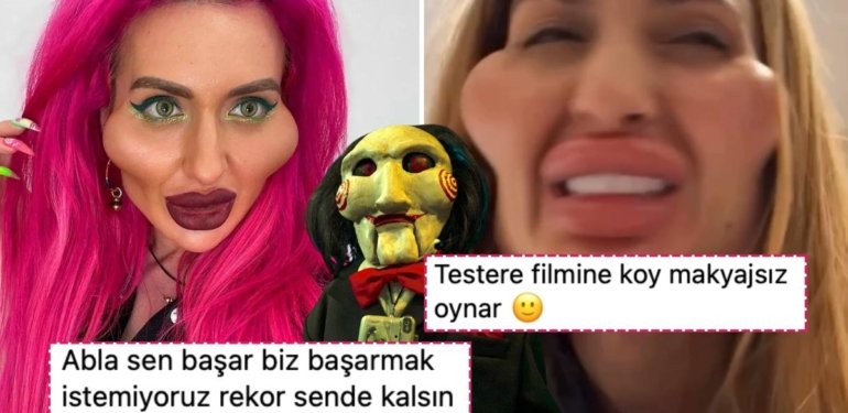 Dünyanın En Büyük Elmacık Kemiklerine Sahip Anastasia Ameliyat Olmak İçin Bir Kez Daha İstanbul’a Geldi!