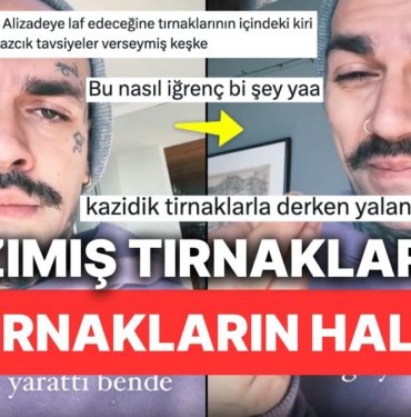Ezhel’in Pislikten Görünmeyen Tırnak Dipleri İçinizi Kaldıracak