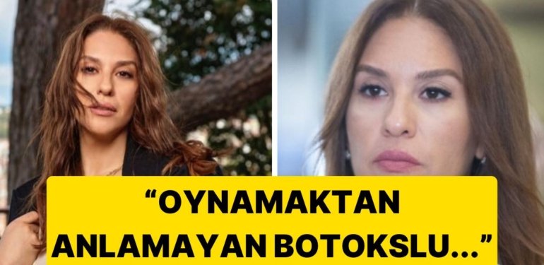 Kızılcık Şerbeti’nin Kıvılcım’ı Evrim Alasya’dan “Botokslu Oyunculara” Gönderme!