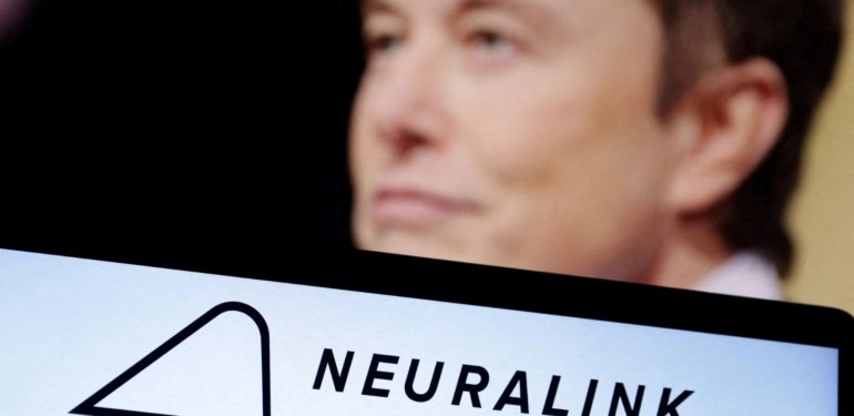 Elon Musk’ın rakibi, ALS hastası adama beyin çipi taktı