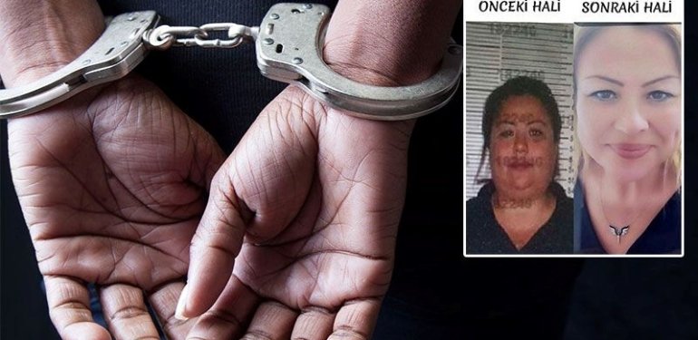 19 ayrı suçtan aranıyordu: Kimliğini kullandığı kardeşine benzemek için estetik yaptırmış