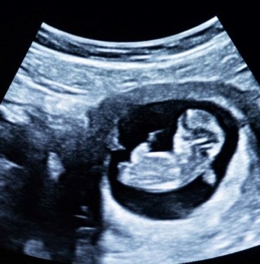 Fetüs sıvısından “mini organlar” üretildi