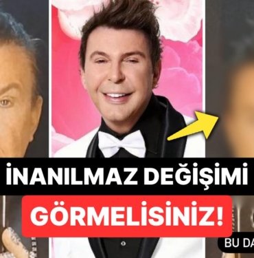 Abartılı Bulunan Estetik İddialarıyla Gündemden Düşmeyen Kuşum Aydın’ın Filtreli ve Filtresiz Hali Olay Oldu