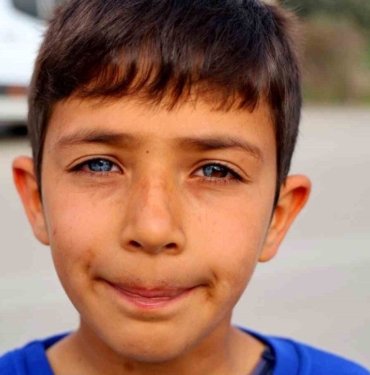 Görenler hayrete düşüyor: Bir gözü mavi, diğer gözünün yarısı mavi yarısı kahverengi