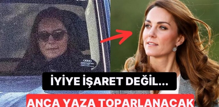 Ameliyattan Sonra Aylarca Ortalardan Kaybolan Kate Middleton İşinin Başına Bu Yaz Dönebilecek