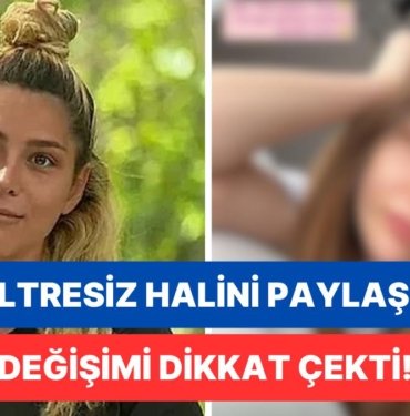 İsmail Balaban’la Evlenerek Şaşırtmıştı: Estetikleriyle Övünen Survivor İlayda Şeker’den Filtresiz Fotoğraf