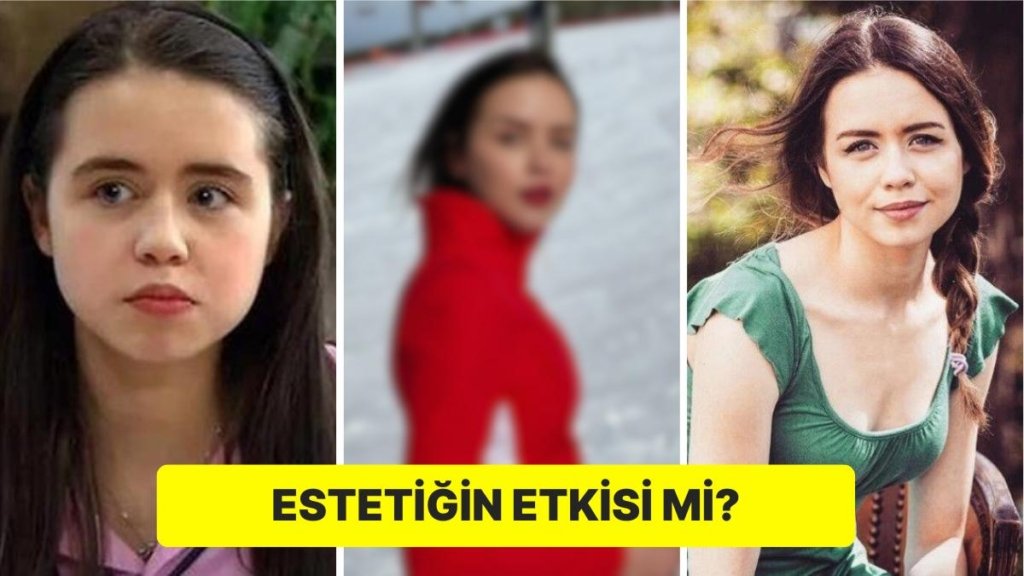 ‘Alemin Kralı’ Dizisiyle Tanıdığımız Oyuncu Yağmur Ün’ün Son Hali Büyüledi