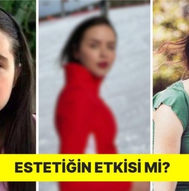 ‘Alemin Kralı’ Dizisiyle Tanıdığımız Oyuncu Yağmur Ün’ün Son Hali Büyüledi